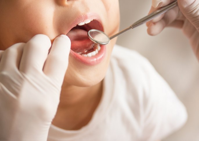 先天性欠損歯について